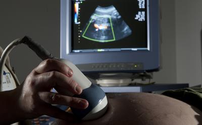 Ultrasound scan
